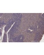 IHC easy ® SPAG5 Ready-To-Use IHC Kit KHC2824 proteintech