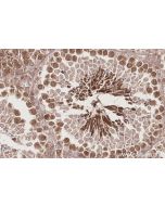 IHC easy ® KIF2C Ready-To-Use IHC Kit KHC2845 proteintech