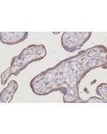IHC easy ® HEATR5B Ready-To-Use IHC Kit KHC2992 proteintech