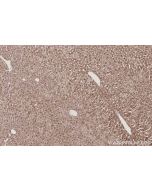 IHC easy ® USP24 Ready-To-Use IHC Kit KHC3047 proteintech