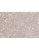 IHC easy ® C15orf23 Ready-To-Use IHC Kit KHC3070 proteintech