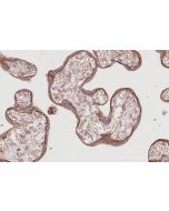 IHC easy ® DAAM1 Ready-To-Use IHC Kit KHC3071 proteintech
