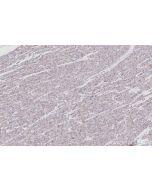 IHC easy ® Vinculin Ready-To-Use IHC Kit KHC3081 proteintech