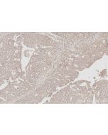 IHC easy ® STYXL1 Ready-To-Use IHC Kit KHC3092 proteintech