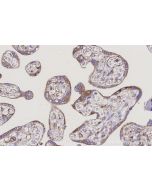 IHC easy ® PLOD3 Ready-To-Use IHC Kit KHC3147 proteintech