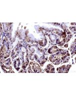 IHC easy ® RPS2 Ready-To-Use IHC Kit KHC3186 proteintech