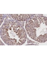 IHC easy ® CCT4 Ready-To-Use IHC Kit KHC3222 proteintech