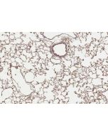 IHC easy ® UBE2M/UBC12 Ready-To-Use IHC Kit KHC3235 proteintech