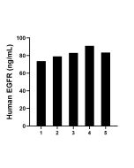 EGFR Recombinant Matched Antibody Pair, PBS Only MP01744-3 proteintech