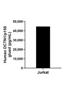 DCTN1/p150 glued Recombinant Matched Antibody Pair, PBS Only MP01959-1 proteintech