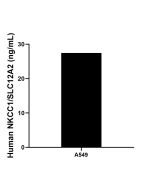 NKCC1/SLC12A2 Recombinant Matched Antibody Pair, PBS Only MP02567-1 proteintech