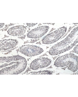 RNA Methylation Essentials Antibody Kit PK30016 proteintech