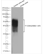 Exosome Expanded Antibody Kit PK30024 proteintech