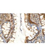 Multi-rAb® SMAD2 Multi-Recombinant antibody RMX00035 proteintech
