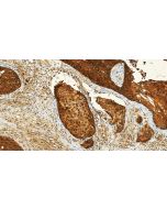 Multi-rAb® CDKN2A/P16-INK4A Multi-Recombinant antibody RMX00038 proteintech