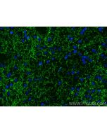 Multi-rAb® TH Multi-Recombinant antibody RMX00053 proteintech