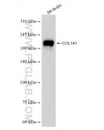 Collagen Type I Recombinant monoclonal antibody Proteintech  86093-1-RR