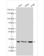 EIF4E Polyclonal antibody Proteintech  11149-1-AP