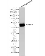 Thyroid Hormone Receptor beta Recombinant monoclonal antibody Proteintech  83866-2-RR