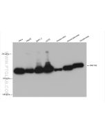RNF160 Recombinant monoclonal antibody Proteintech  82926-1-RR
