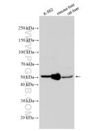 ALDH1A1 Polyclonal antibody Proteintech  15910-1-AP
