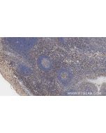 Anti-Human CD3 Mouse Recombinant Antibody Proteintech  98319-2-MR