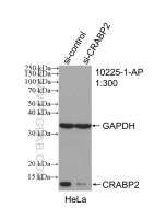 CRABP2 Polyclonal antibody Proteintech  10225-1-AP
