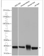 Gamma Cystathionase Polyclonal antibody Proteintech  12217-1-AP