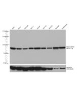 Beta Catenin Monoclonal antibody Proteintech  66379-1-Ig