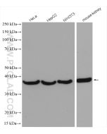 Annexin A2 Polyclonal antibody Proteintech  11256-1-AP
