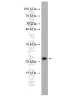 BAD Polyclonal antibody Proteintech  10435-1-AP