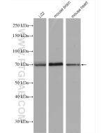 SPHK2 Polyclonal antibody Proteintech  17096-1-AP