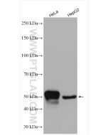 Cytokeratin 7 Polyclonal antibody Proteintech  15539-1-AP