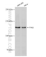 TYK2 Recombinant monoclonal antibody Proteintech  83161-4-RR