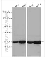 Cytokeratin 8 Polyclonal antibody Proteintech  17514-1-AP