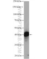 TIA1 Polyclonal antibody Proteintech  12133-2-AP