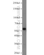 CYP1A1 Polyclonal antibody Proteintech  13241-1-AP