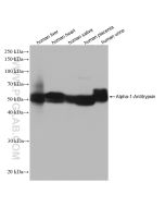 Alpha-1-Antitrypsin Recombinant monoclonal antibody Proteintech  82918-1-RR