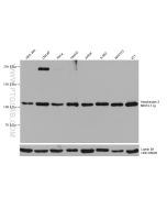 Hexokinase 2 Monoclonal antibody Proteintech  66974-1-Ig