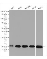 NRAS Polyclonal antibody Proteintech  10724-1-AP