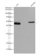 PAX6 Polyclonal antibody Proteintech  12323-1-AP