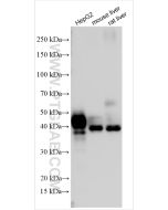 ASGR1 Polyclonal antibody Proteintech  11739-1-AP