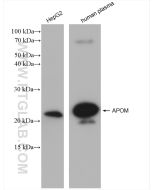 APOM Recombinant monoclonal antibody Proteintech  82871-1-RR