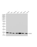 HMGB2 Recombinant monoclonal antibody Proteintech  83482-4-RR