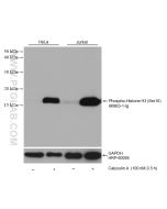Phospho-Histone H3 (Ser10) Monoclonal antibody Proteintech  66863-1-Ig