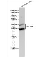 SHBG Recombinant monoclonal antibody Proteintech  83096-1-RR