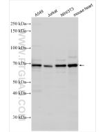 MITF Polyclonal antibody Proteintech  13092-1-AP