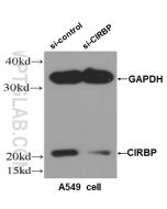 CIRBP Polyclonal antibody Proteintech  10209-2-AP