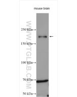 Nestin Polyclonal antibody Proteintech  19483-1-AP