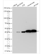 CKB-Specific Recombinant monoclonal antibody Proteintech  83522-5-RR